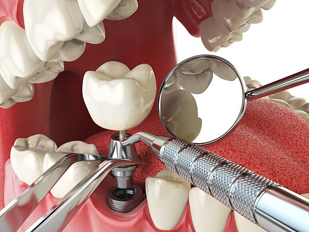 Fast & Reliable Emergency Dental Services in ID